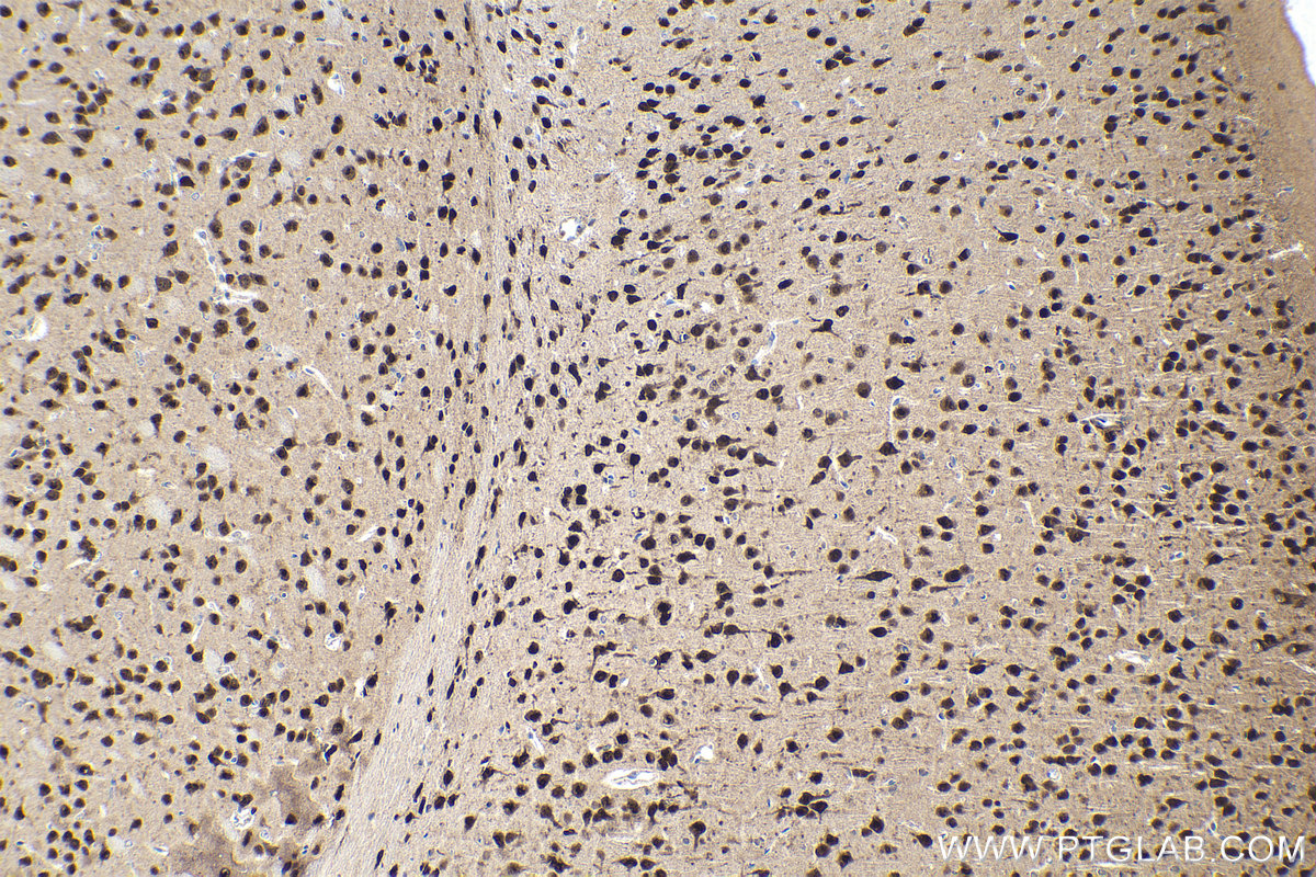 Immunohistochemical analysis of paraffin-embedded mouse brain tissue slide using KHC1966 (RBFOX1/A2BP1 IHC Kit).