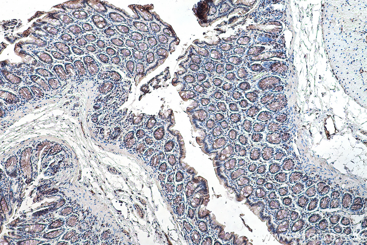 Immunohistochemical analysis of paraffin-embedded rat colon tissue slide using KHC0151 (RBM15B IHC Kit).