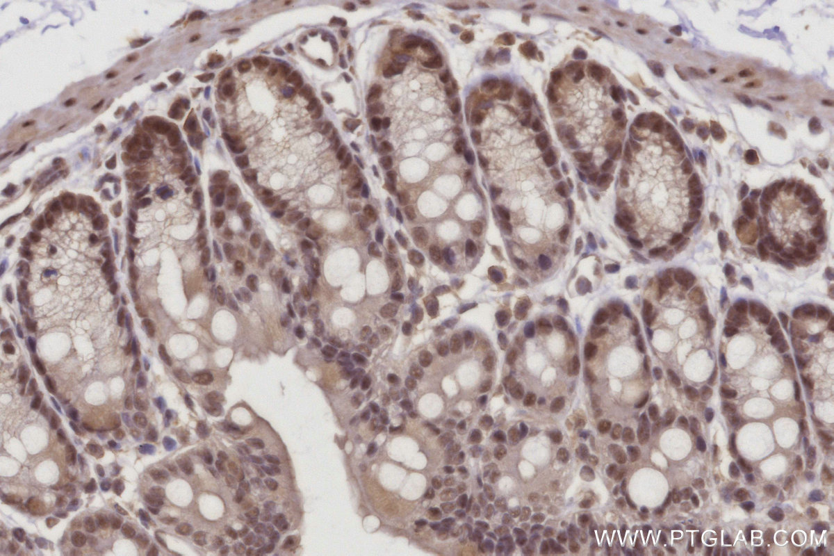 Immunohistochemical analysis of paraffin-embedded mouse colon tissue slide using KHC2965 (RBM22 IHC Kit).