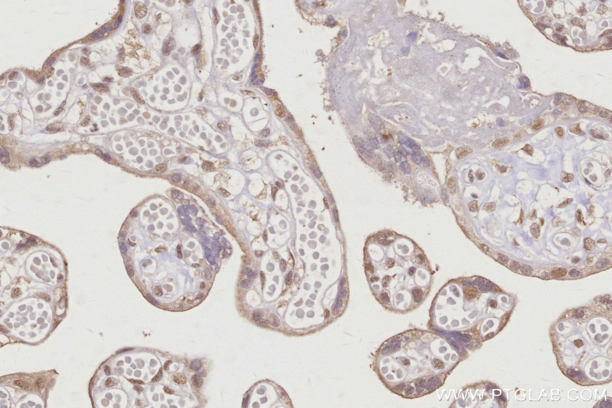 Immunohistochemical analysis of paraffin-embedded human placenta tissue slide using KHC2965 (RBM22 IHC Kit).
