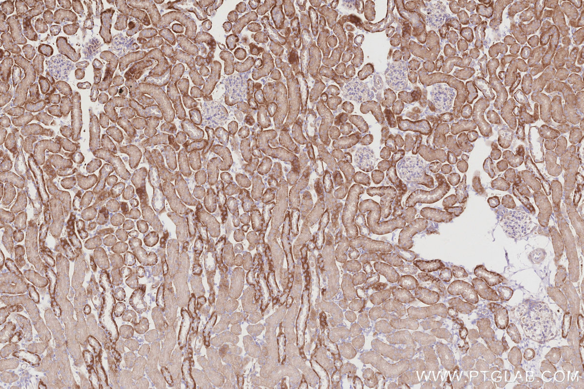 Immunohistochemical analysis of paraffin-embedded mouse kidney tissue slide using KHC2901 (RBM38 IHC Kit).