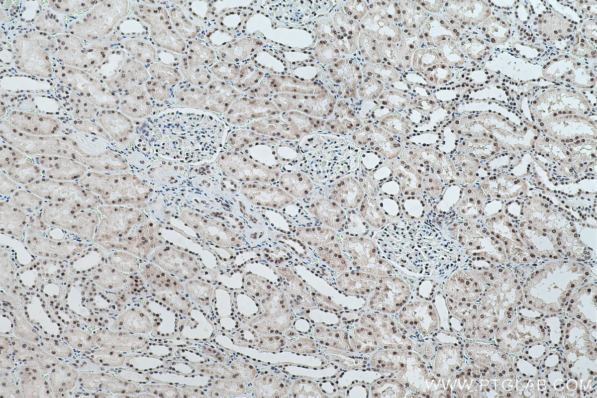 Immunohistochemical analysis of paraffin-embedded human kidney tissue slide using KHC0497 (RBM39 IHC Kit).