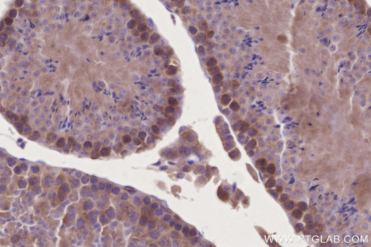 Immunohistochemical analysis of paraffin-embedded mouse testis tissue slide using KHC2710 (RBM46 IHC Kit).
