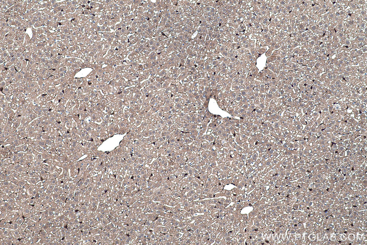 Immunohistochemical analysis of paraffin-embedded mouse liver tissue slide using KHC0453 (RBP1 IHC Kit).