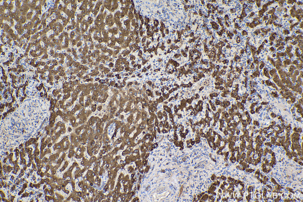 Immunohistochemical analysis of paraffin-embedded human liver tissue slide using KHC2156 (RBP4 IHC Kit).