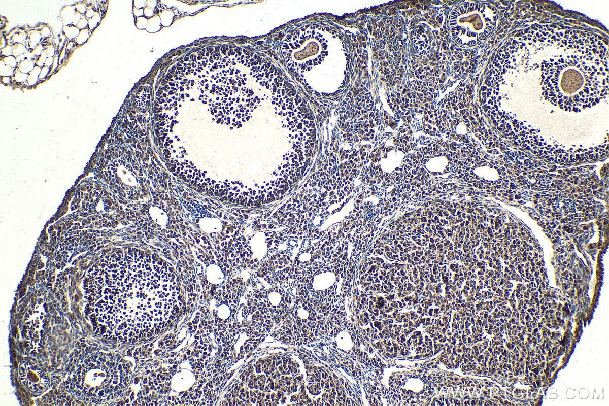 Immunohistochemical analysis of paraffin-embedded mouse ovary tissue slide using KHC2050 (RCAS1 IHC Kit).