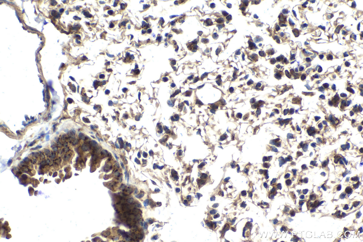 Immunohistochemical analysis of paraffin-embedded mouse lung tissue slide using KHC2050 (RCAS1 IHC Kit).