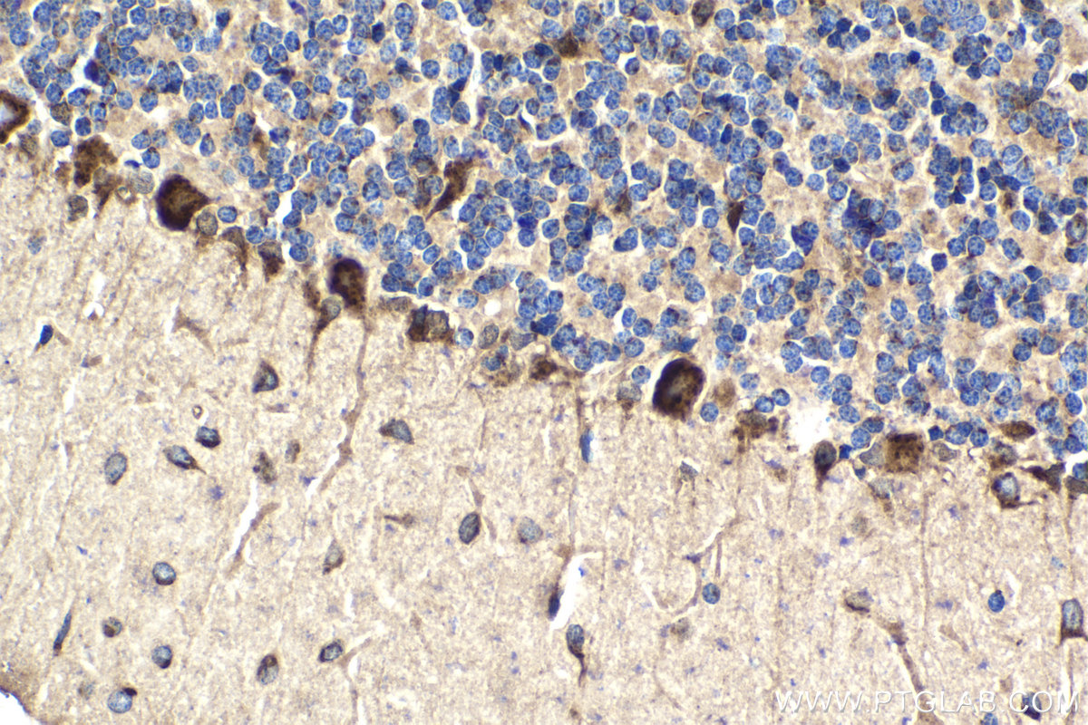 Immunohistochemical analysis of paraffin-embedded rat cerebellum tissue slide using KHC2050 (RCAS1 IHC Kit).