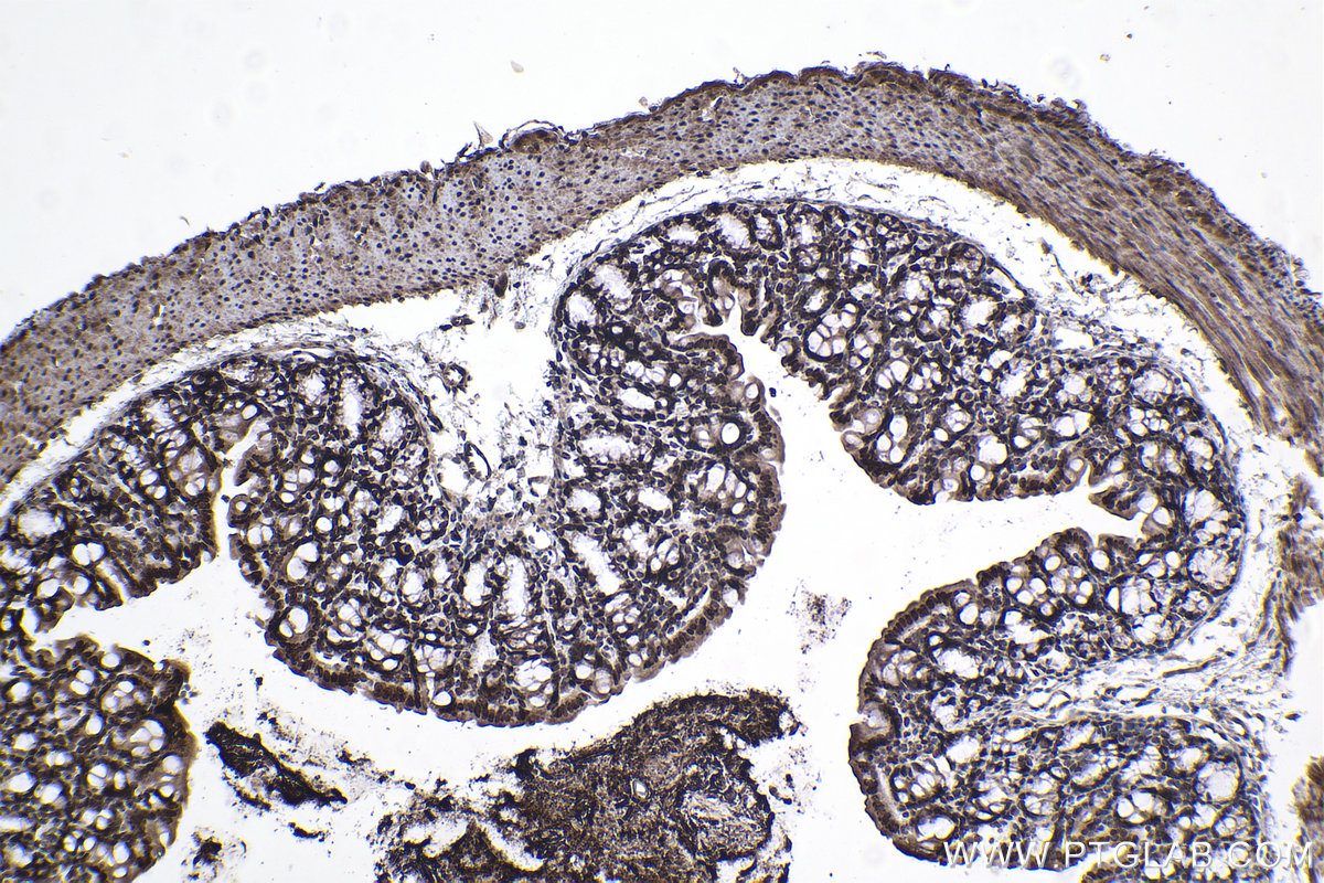 Immunohistochemical analysis of paraffin-embedded mouse colon tissue slide using KHC1015 (RCC2 IHC Kit).