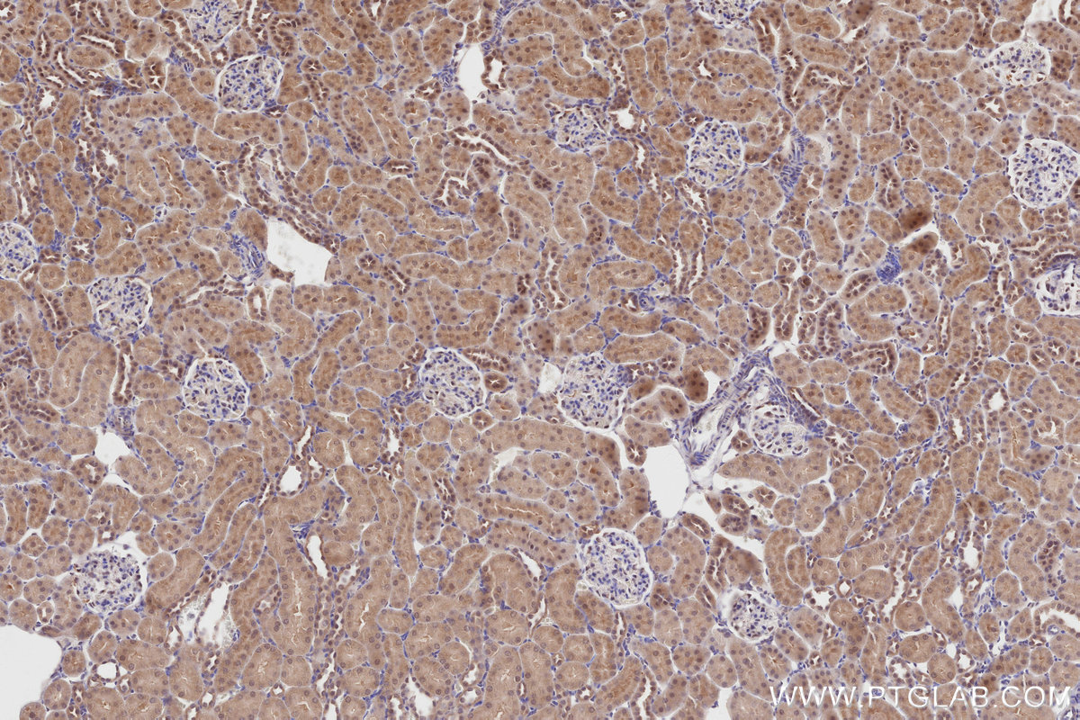 Immunohistochemical analysis of paraffin-embedded rat kidney tissue slide using KHC2814 (RCHY1/Pirh2 IHC Kit).