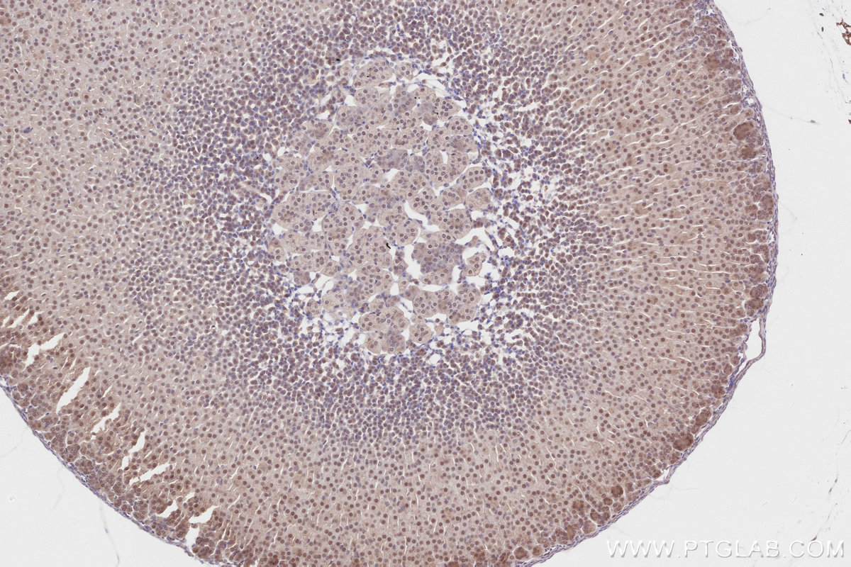 Immunohistochemical analysis of paraffin-embedded mouse adrenal gland tissue slide using KHC2814 (RCHY1/Pirh2 IHC Kit).