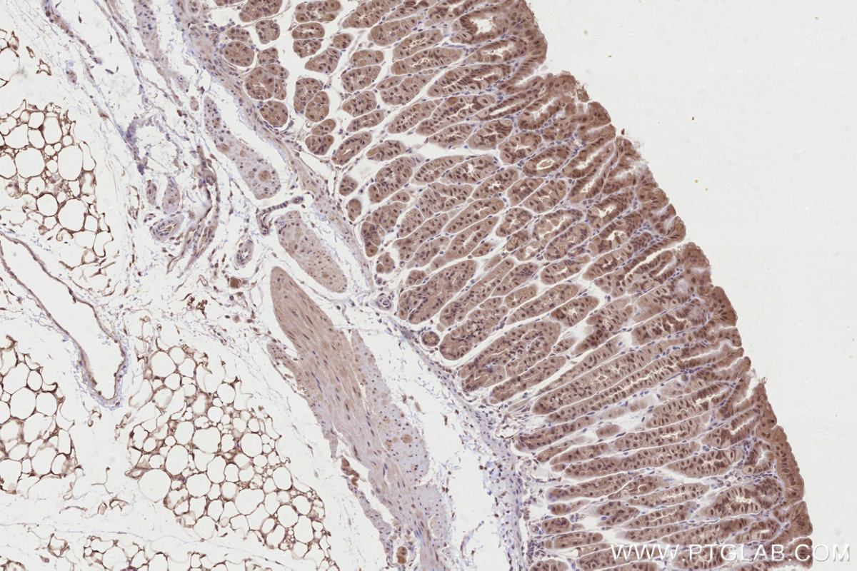 Immunohistochemical analysis of paraffin-embedded mouse stomach tissue slide using KHC2814 (RCHY1/Pirh2 IHC Kit).
