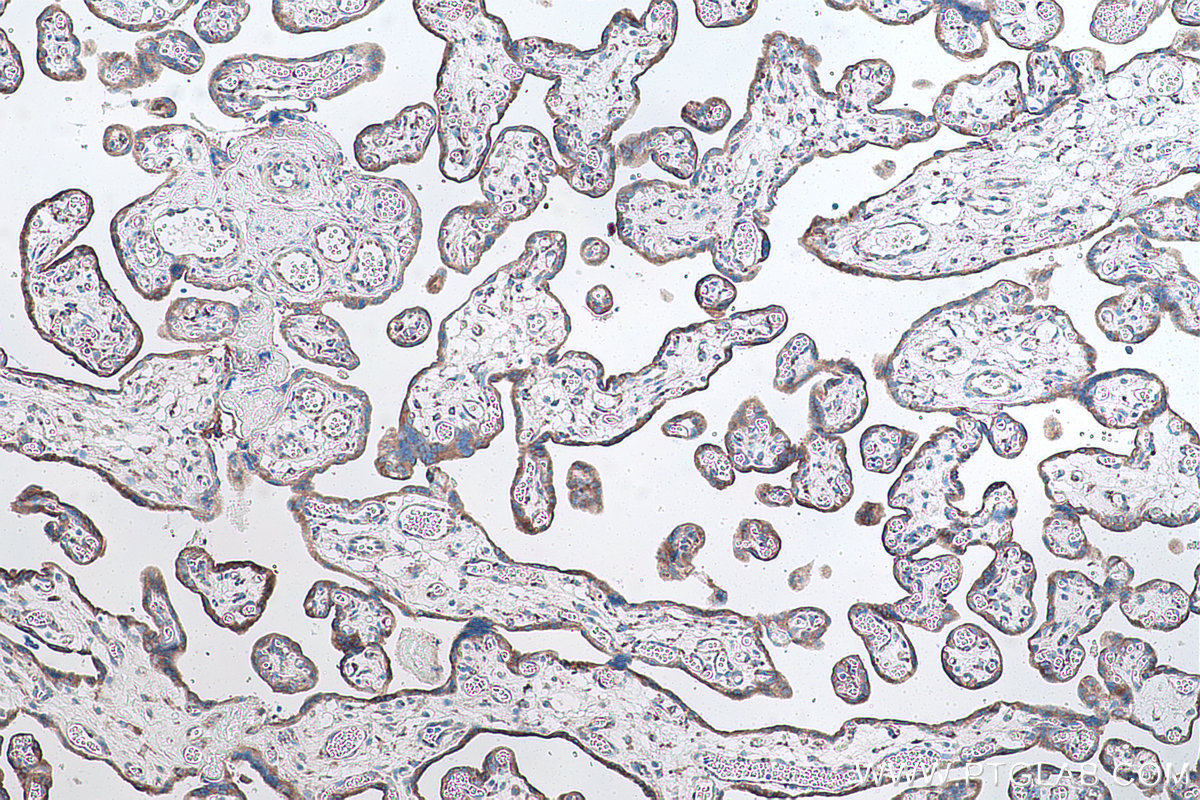 Immunohistochemical analysis of paraffin-embedded human placenta tissue slide using KHC0862 (RCN2 IHC Kit).