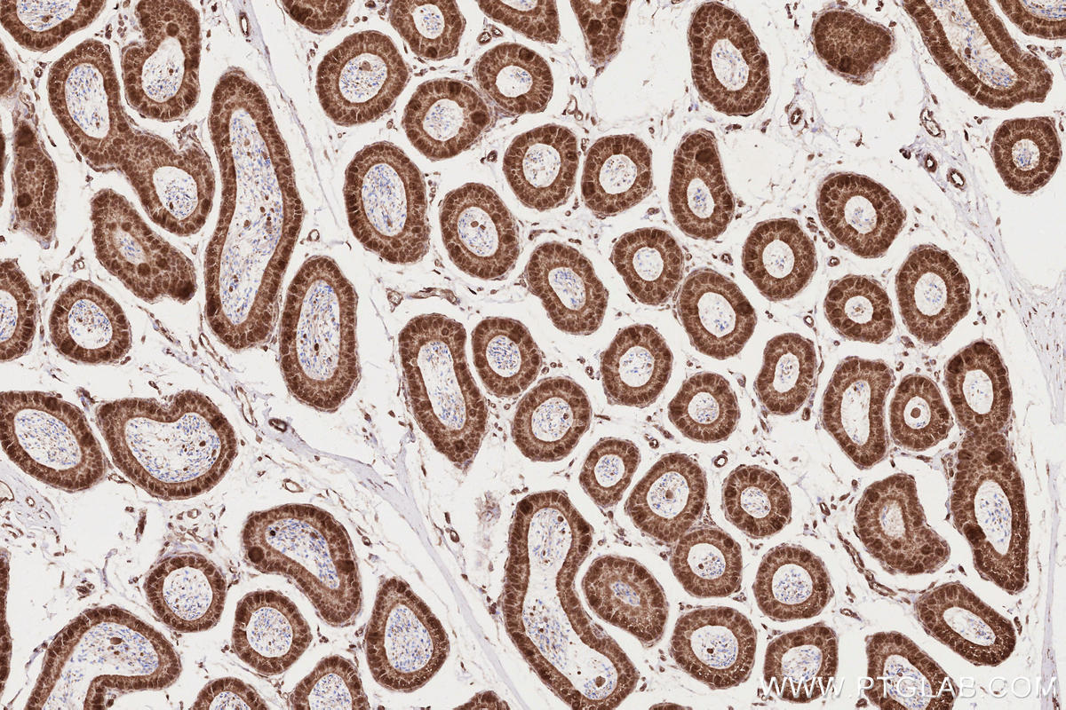 Immunohistochemical analysis of paraffin-embedded mouse epididymis tissue slide using KHC2619 (RD3 IHC Kit).