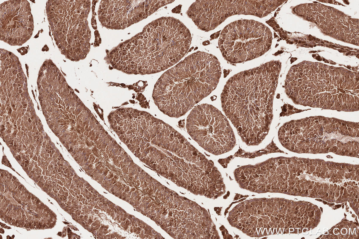 Immunohistochemical analysis of paraffin-embedded mouse testis tissue slide using KHC2619 (RD3 IHC Kit).