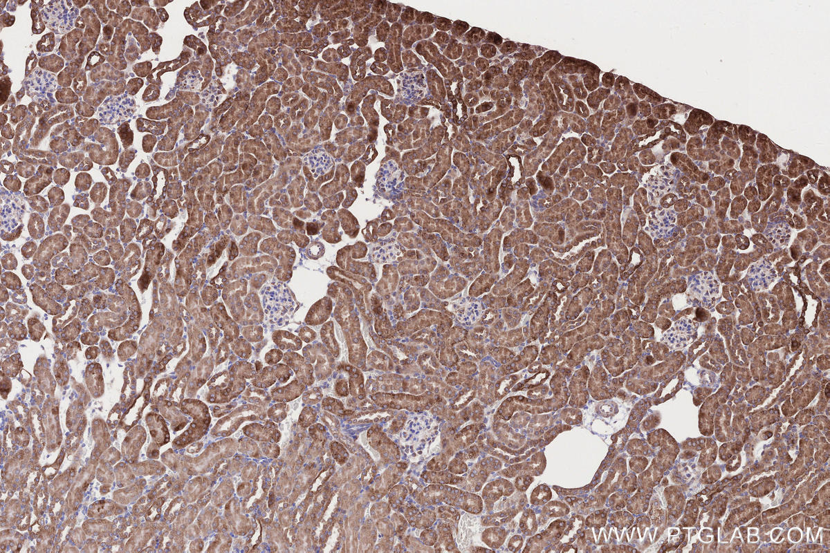 Immunohistochemical analysis of paraffin-embedded mouse kidney tissue slide using KHC2665 (RDH10 IHC Kit).