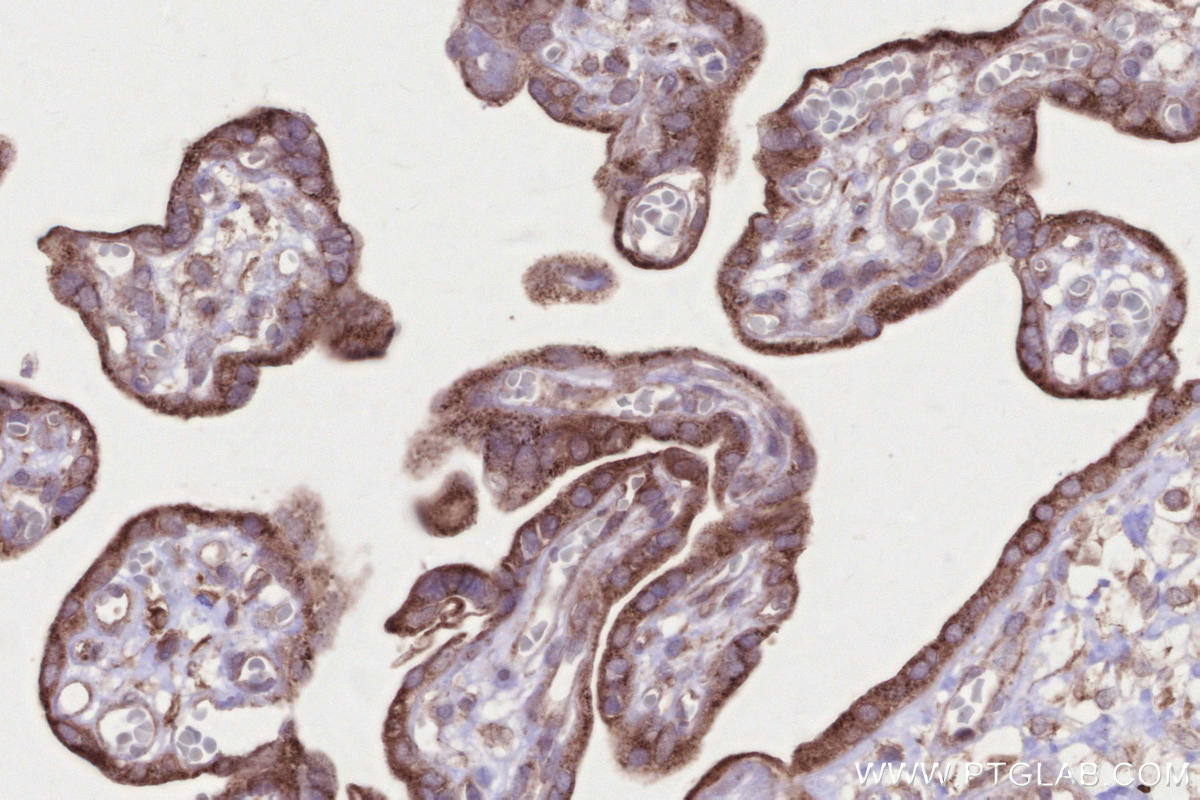Immunohistochemical analysis of paraffin-embedded human placenta tissue slide using KHC2665 (RDH10 IHC Kit).