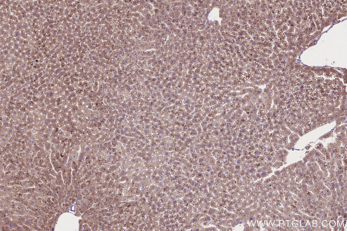 Immunohistochemical analysis of paraffin-embedded mouse liver tissue slide using KHC2665 (RDH10 IHC Kit).