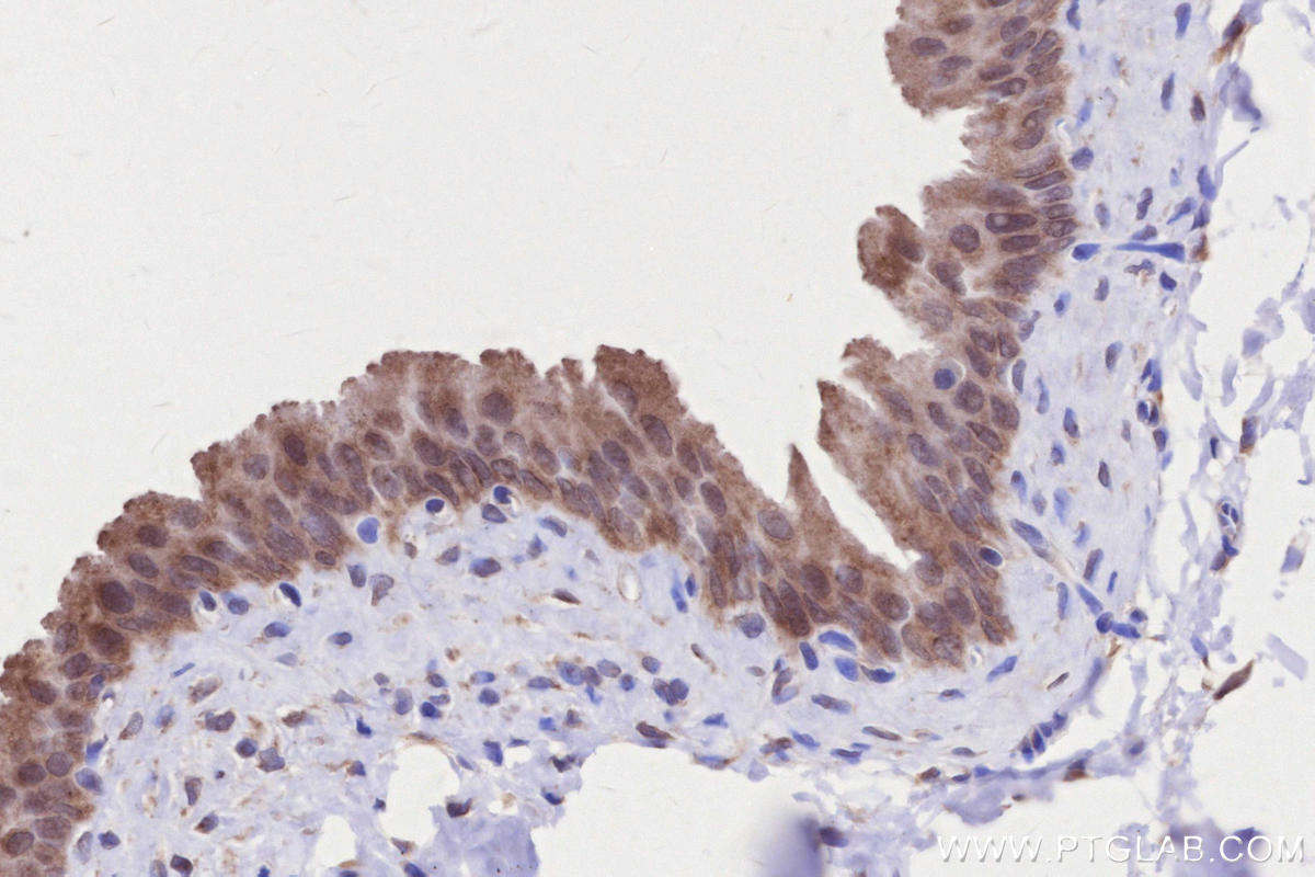 Immunohistochemical analysis of paraffin-embedded rat bladder tissue slide using KHC2665 (RDH10 IHC Kit).