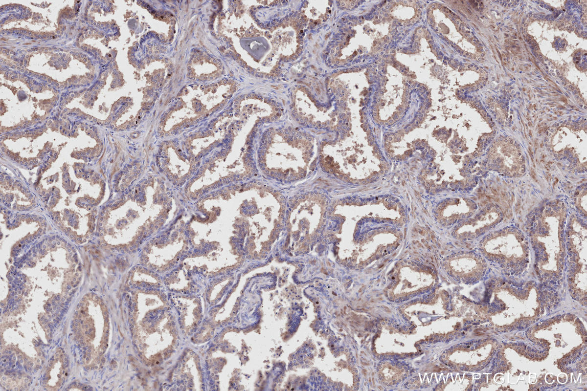Immunohistochemical analysis of paraffin-embedded human prostate hyperplasia tissue slide using KHC2712 (RDH11 IHC Kit).