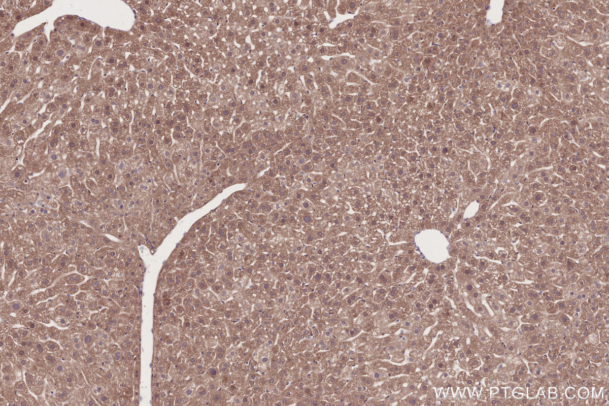 Immunohistochemical analysis of paraffin-embedded mouse liver tissue slide using KHC2753 (RDH5 IHC Kit).