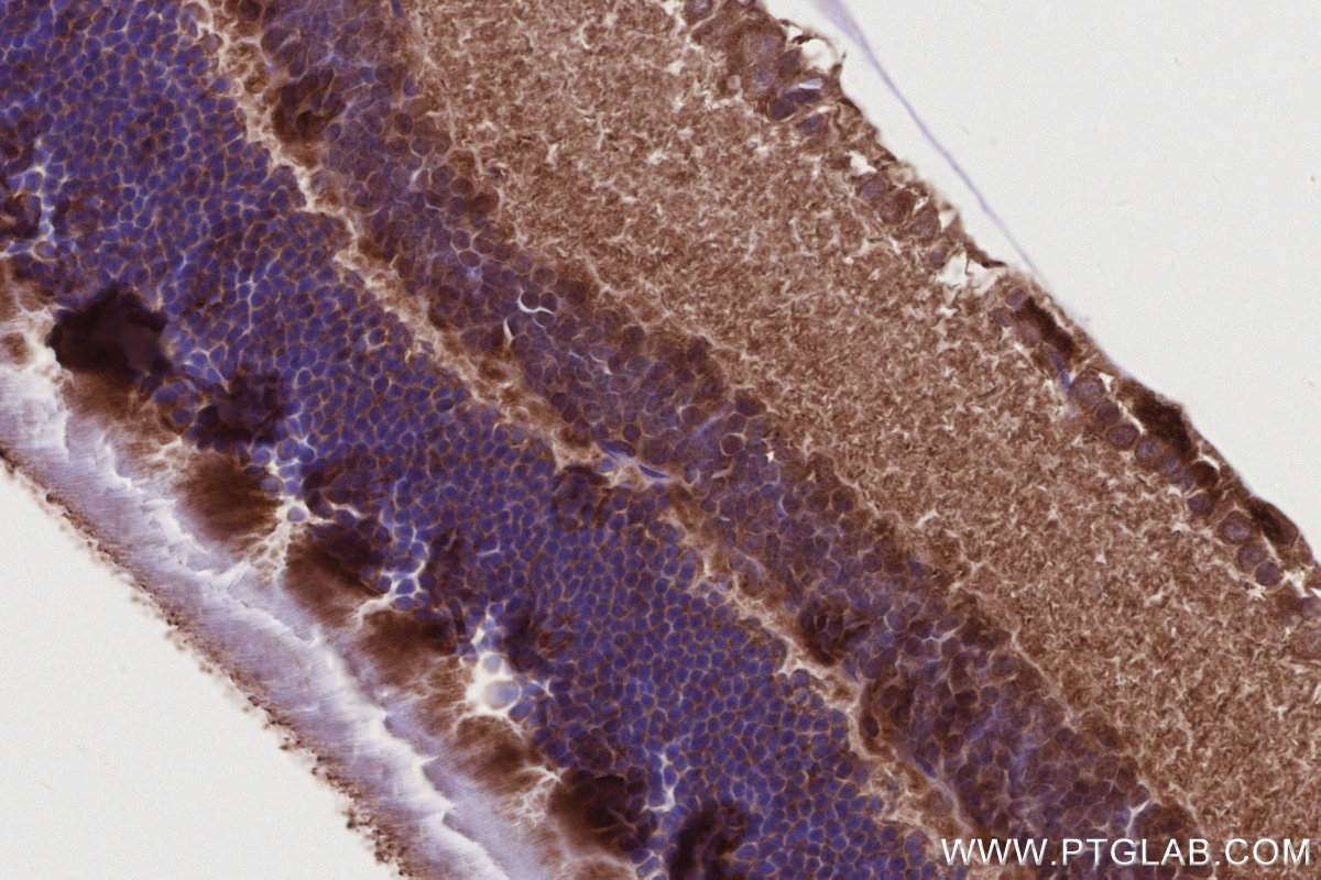 Immunohistochemical analysis of paraffin-embedded mouse eye tissue slide using KHC2753 (RDH5 IHC Kit).