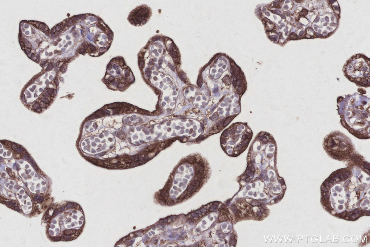 Immunohistochemical analysis of paraffin-embedded human placenta tissue slide using KHC2920 (REEP4 IHC Kit).