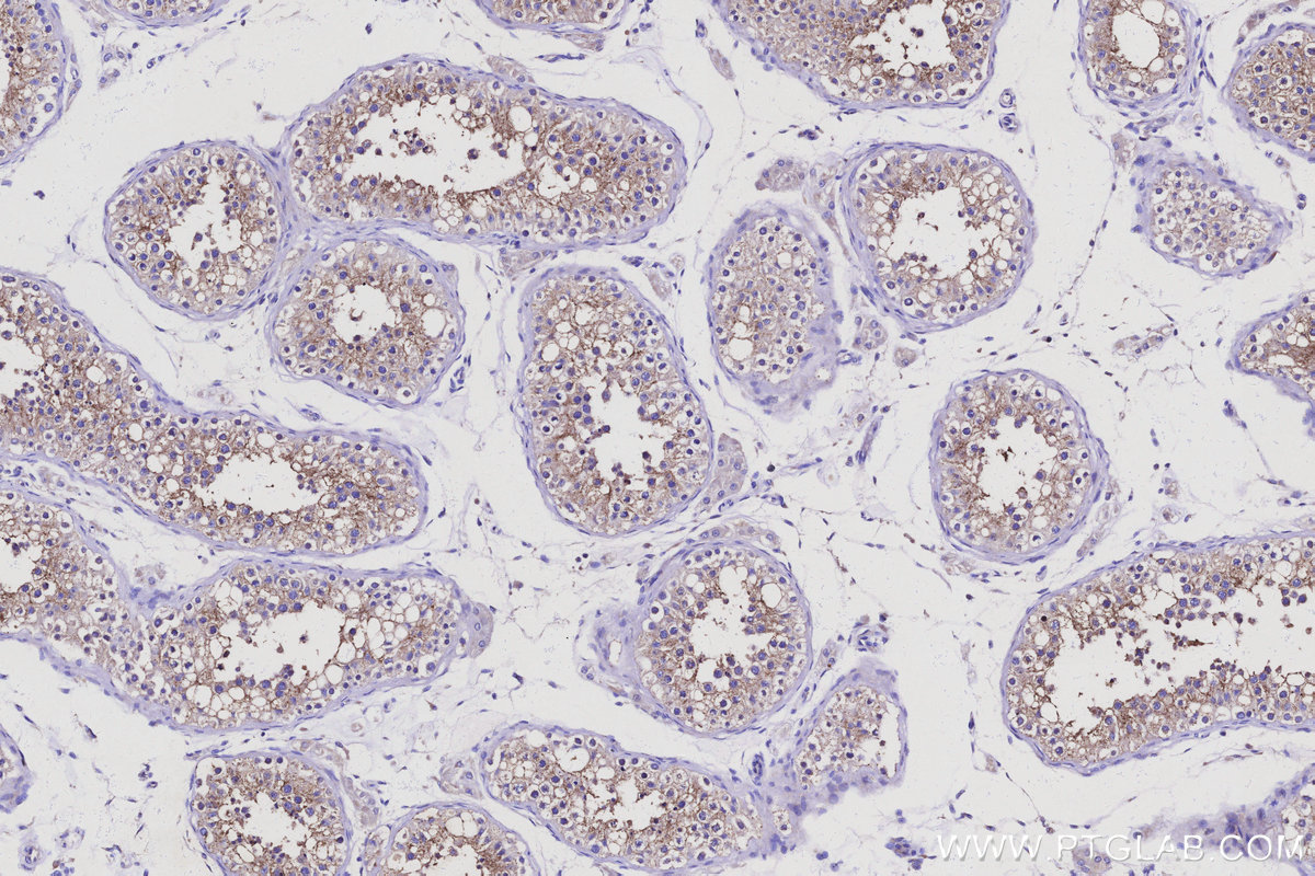 Immunohistochemical analysis of paraffin-embedded human testis tissue slide using KHC3113 (RGPD5 IHC Kit). Immunohistochemical analysis of paraffin-embedded human testis tissue slide using KHC3113 (RGPD5 IHC Kit).