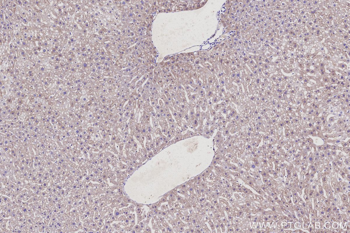 Immunohistochemical analysis of paraffin-embedded mouse liver tissue slide using KHC3113 (RGPD5 IHC Kit). Immunohistochemical analysis of paraffin-embedded mouse liver tissue slide using KHC3113 (RGPD5 IHC Kit).