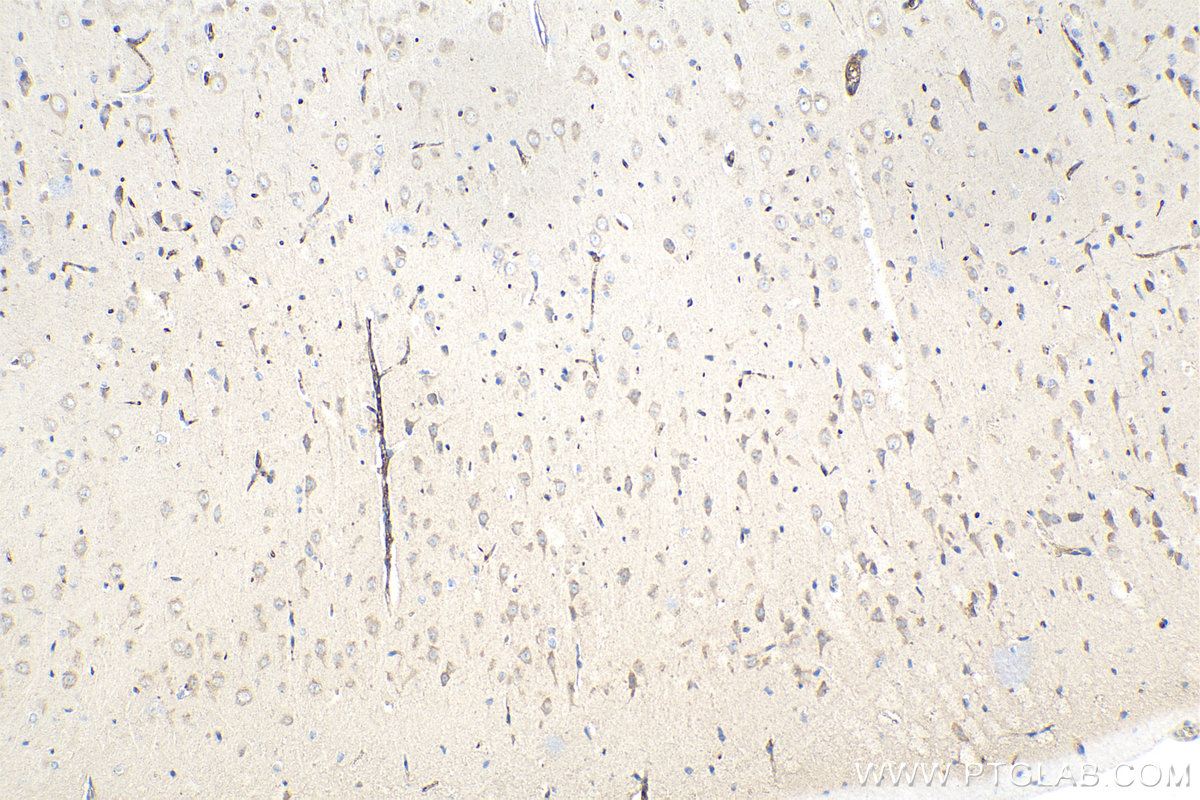 Immunohistochemical analysis of paraffin-embedded rat brain tissue slide using KHC1454 (RGS14 IHC Kit).