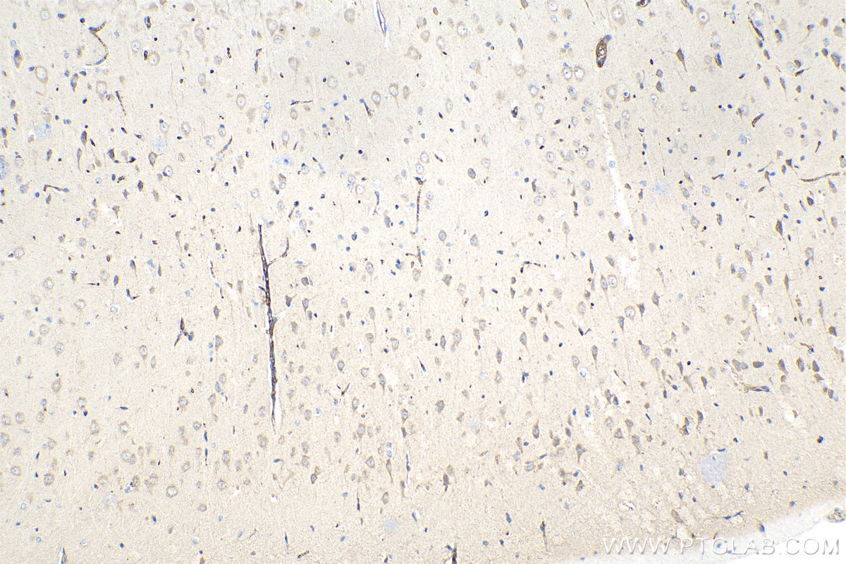 Immunohistochemical analysis of paraffin-embedded rat brain tissue slide using KHC1454 (RGS14 IHC Kit).