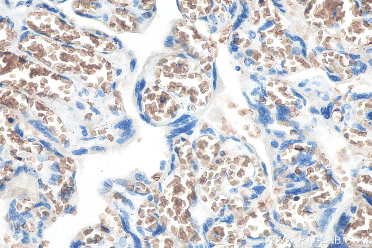 Immunohistochemical analysis of paraffin-embedded human placenta tissue slide using KHC0075 (RHAG IHC Kit).