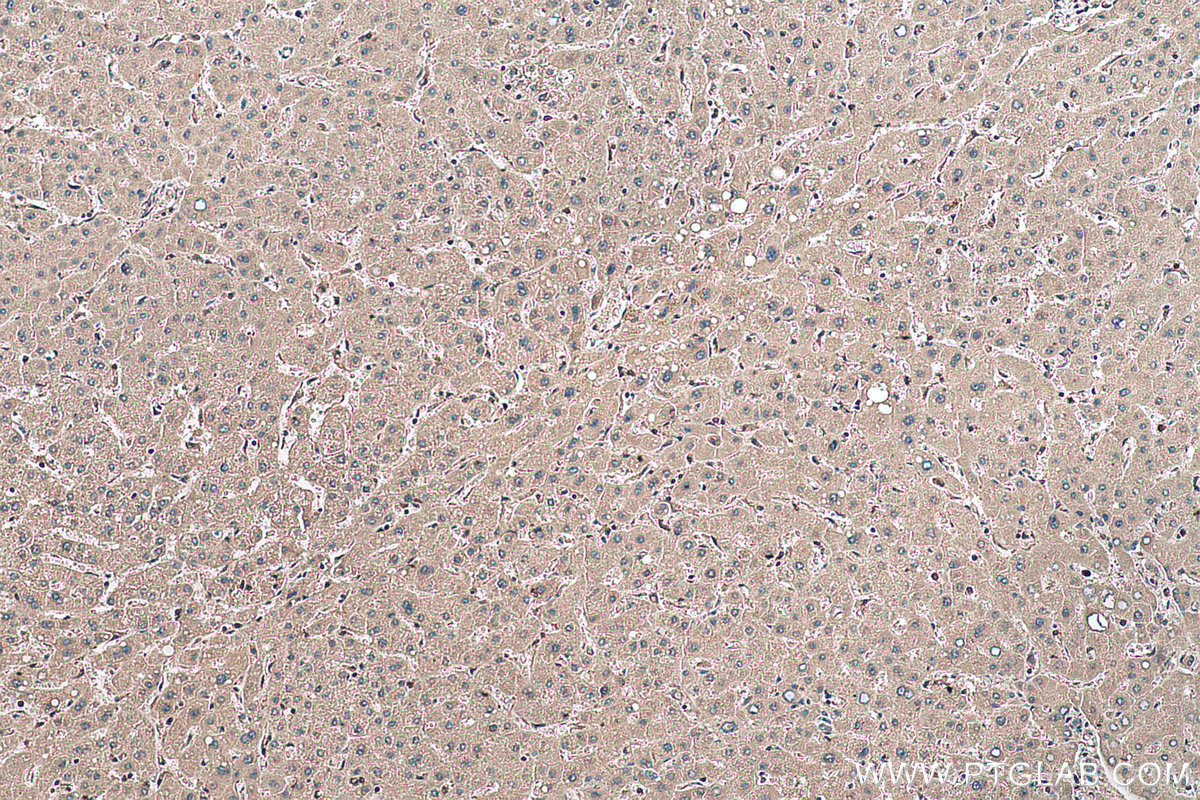 Immunohistochemical analysis of paraffin-embedded human liver tissue slide using KHC0638 (RHOA IHC Kit).