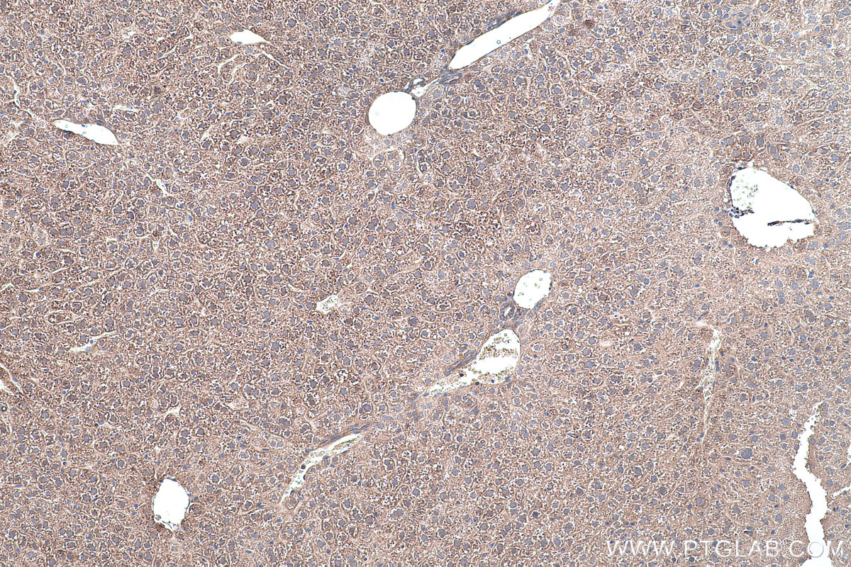 Immunohistochemical analysis of paraffin-embedded mouse liver tissue slide using KHC0454 (RHOB IHC Kit).