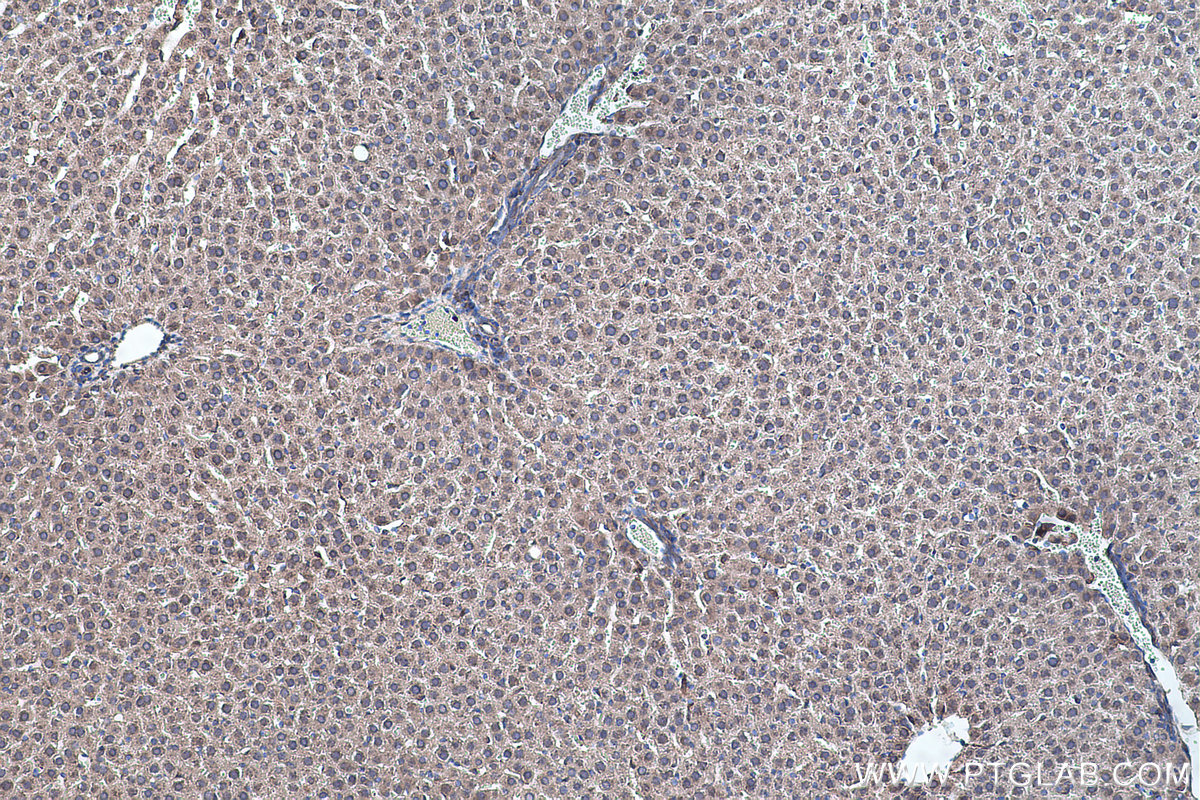 Immunohistochemical analysis of paraffin-embedded rat liver tissue slide using KHC0454 (RHOB IHC Kit).