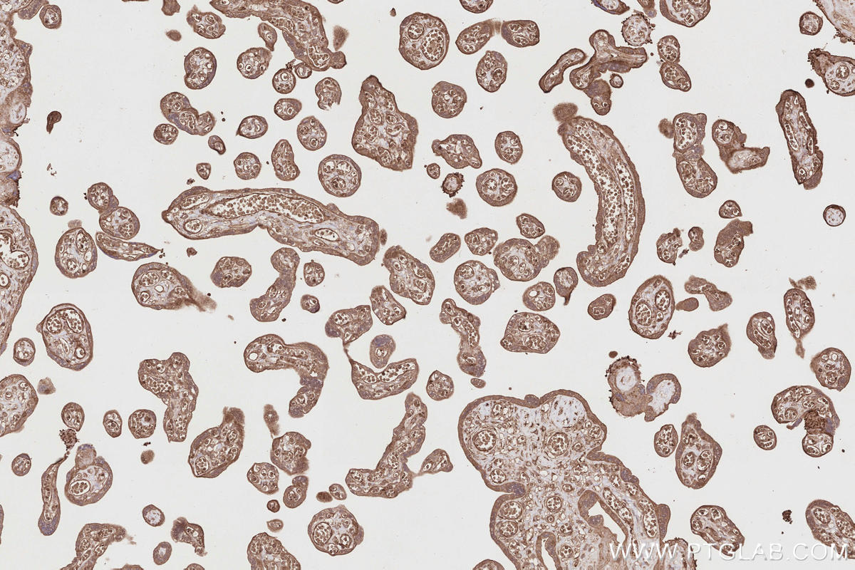 Immunohistochemical analysis of paraffin-embedded human placenta tissue slide using KHC2858 (RIOK1 IHC Kit).