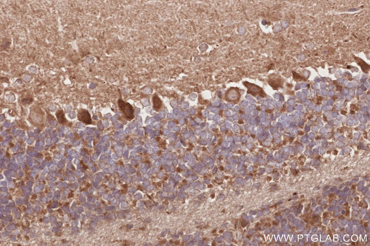 Immunohistochemical analysis of paraffin-embedded mouse cerebellum tissue slide using KHC2858 (RIOK1 IHC Kit).