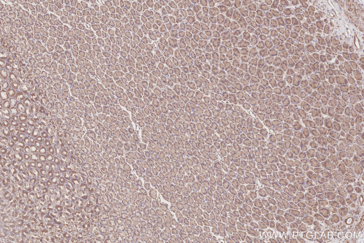 Immunohistochemical analysis of paraffin-embedded rat stomach tissue slide using KHC2858 (RIOK1 IHC Kit).