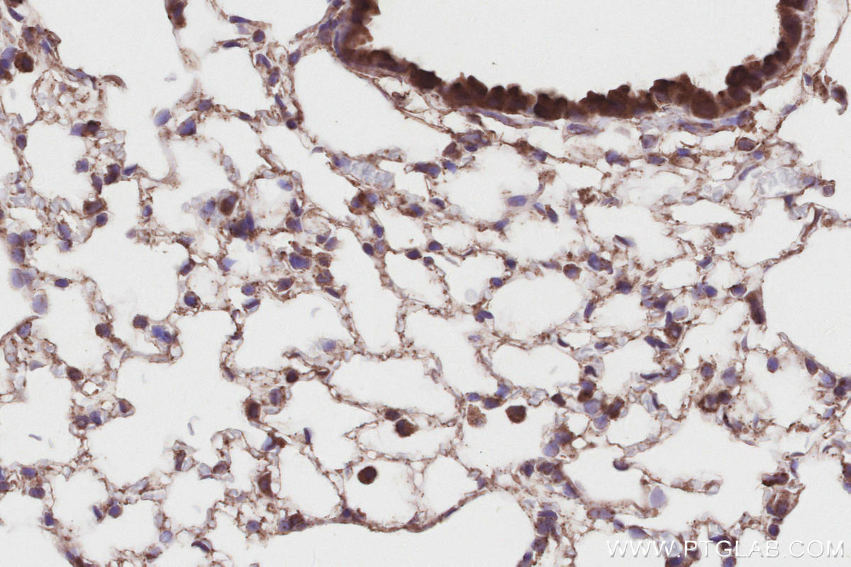 Immunohistochemical analysis of paraffin-embedded mouse lung tissue slide using KHC2874 (RIOK2 IHC Kit).