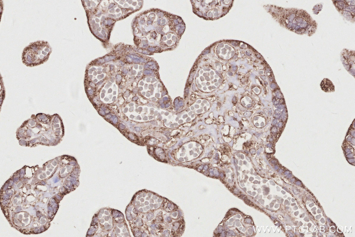 Immunohistochemical analysis of paraffin-embedded human placenta tissue slide using KHC2874 (RIOK2 IHC Kit).