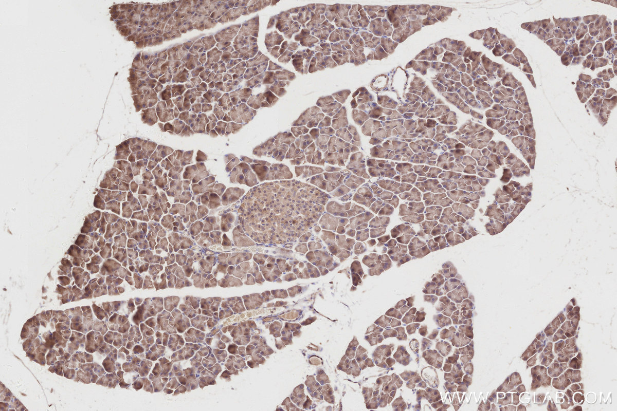 Immunohistochemical analysis of paraffin-embedded mouse pancreas tissue slide using KHC2874 (RIOK2 IHC Kit).