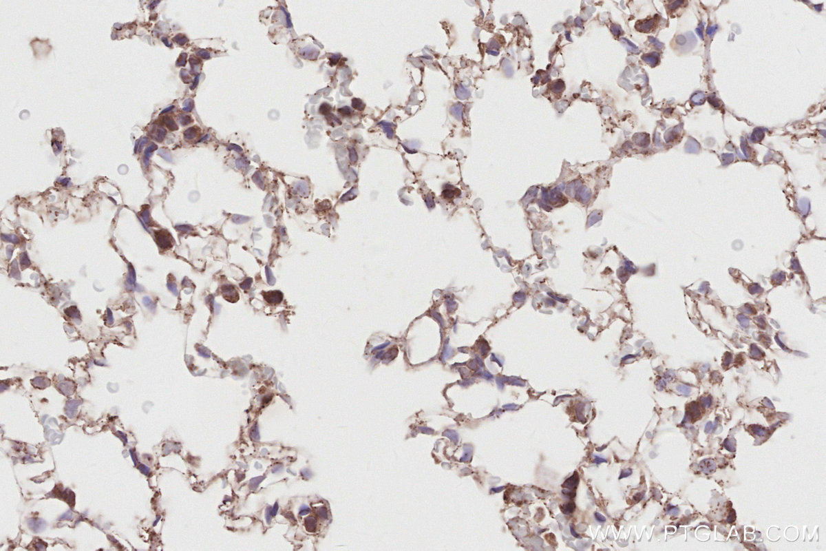 Immunohistochemical analysis of paraffin-embedded rat lung tissue slide using KHC2874 (RIOK2 IHC Kit).