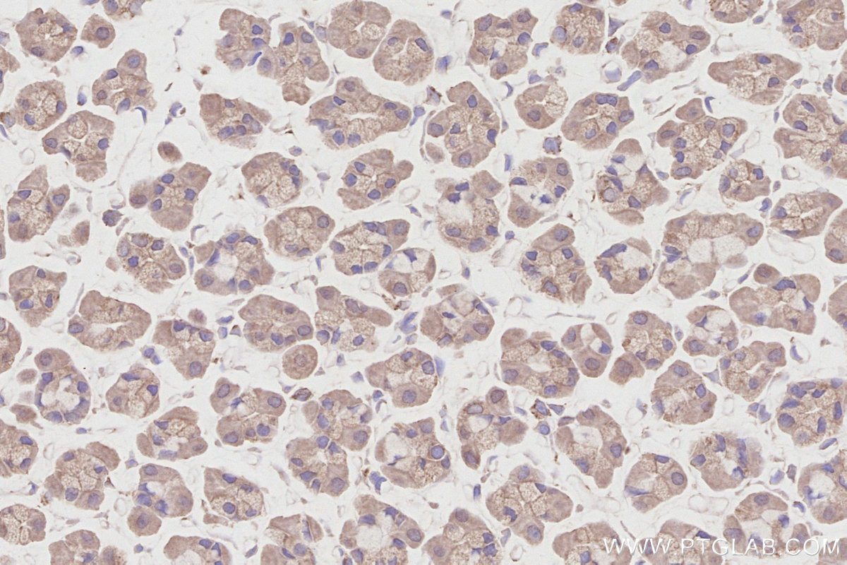 Immunohistochemical analysis of paraffin-embedded rat stomach tissue slide using KHC2874 (RIOK2 IHC Kit).