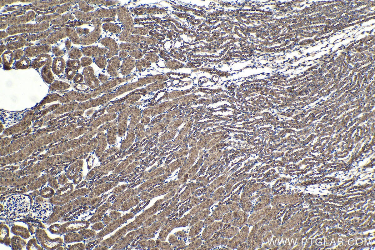 Immunohistochemical analysis of paraffin-embedded mouse kidney tissue slide using KHC2086 (RIPK2 IHC Kit).