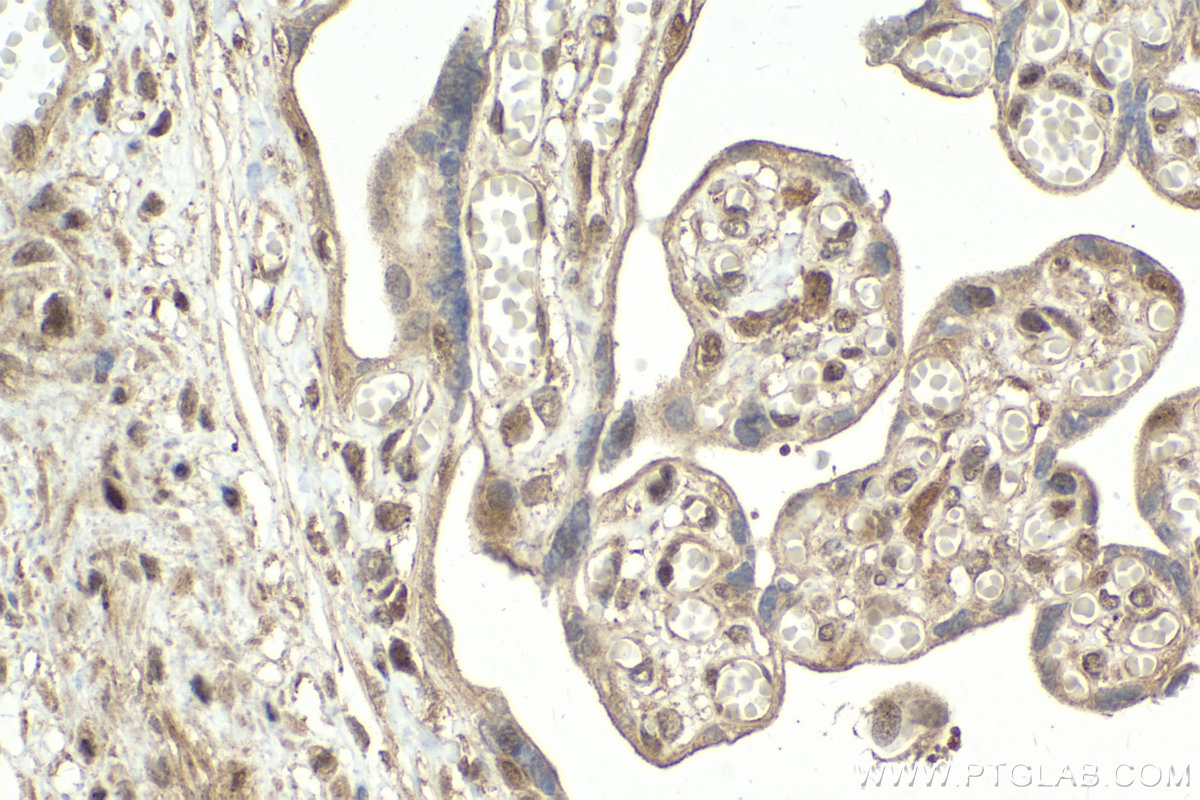Immunohistochemical analysis of paraffin-embedded human placenta tissue slide using KHC2025 (RIPK3 IHC Kit).