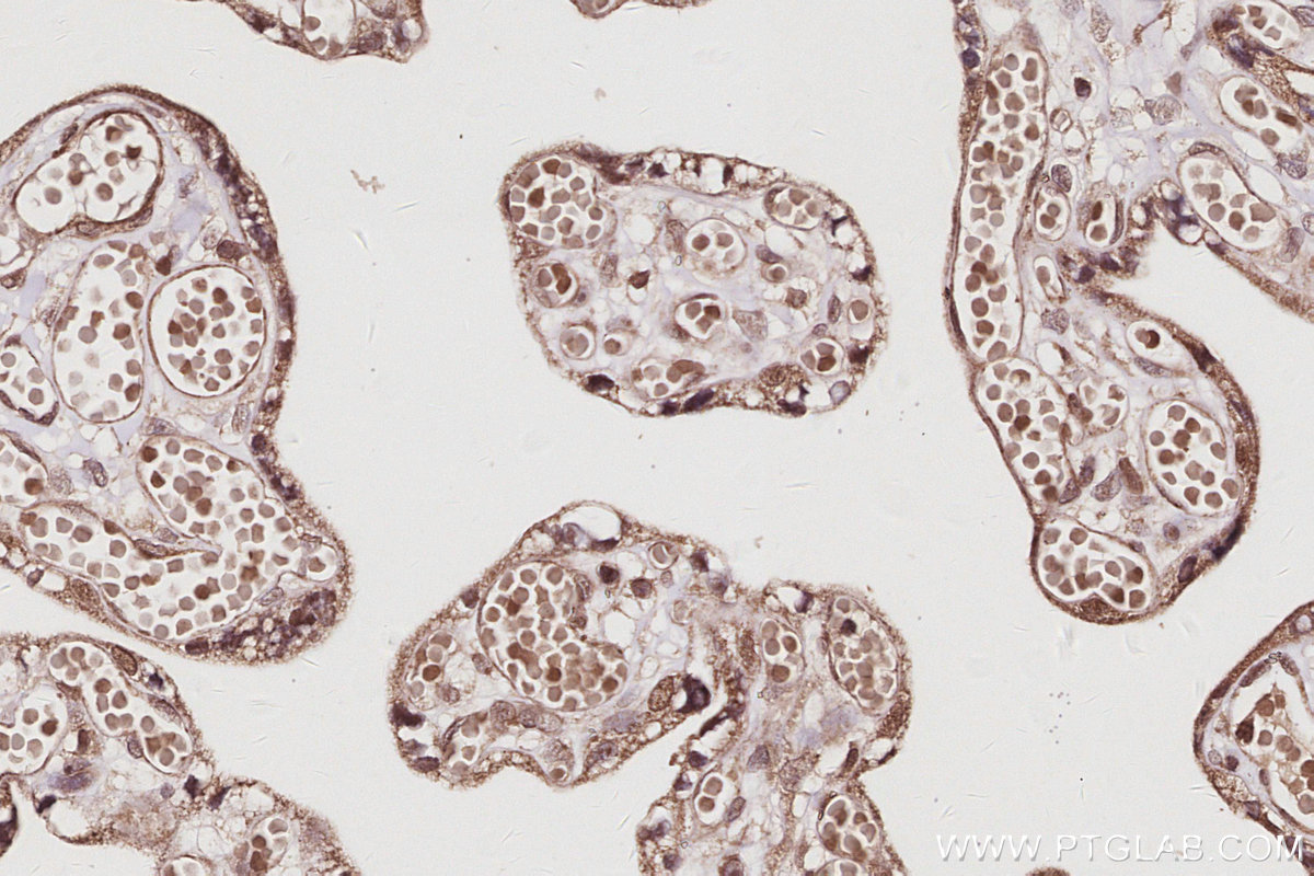 Immunohistochemical analysis of paraffin-embedded human placenta tissue slide using KHC3038 (RNF112 IHC Kit). Immunohistochemical analysis of paraffin-embedded human placenta tissue slide using KHC3038 (RNF112 IHC Kit).
