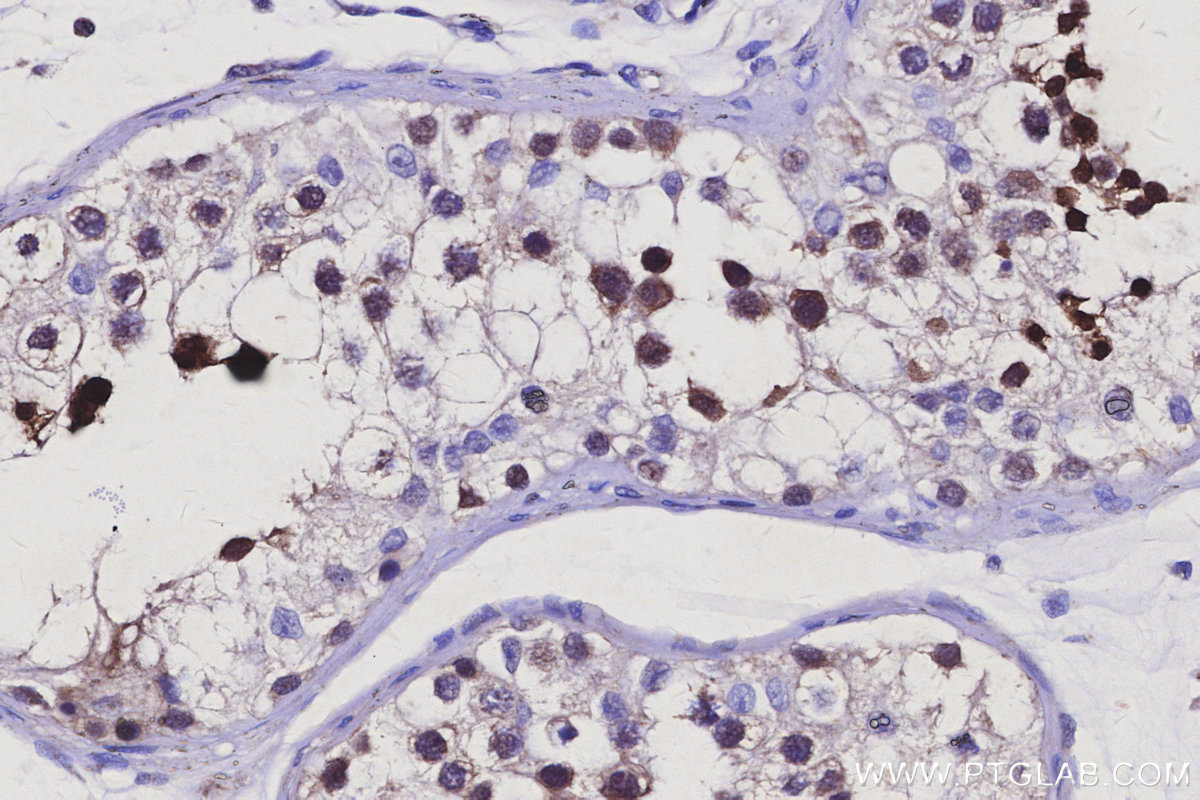 Immunohistochemical analysis of paraffin-embedded human testis tissue slide using KHC3082 (RNF114 IHC Kit). Immunohistochemical analysis of paraffin-embedded human testis tissue slide using KHC3082 (RNF114 IHC Kit).