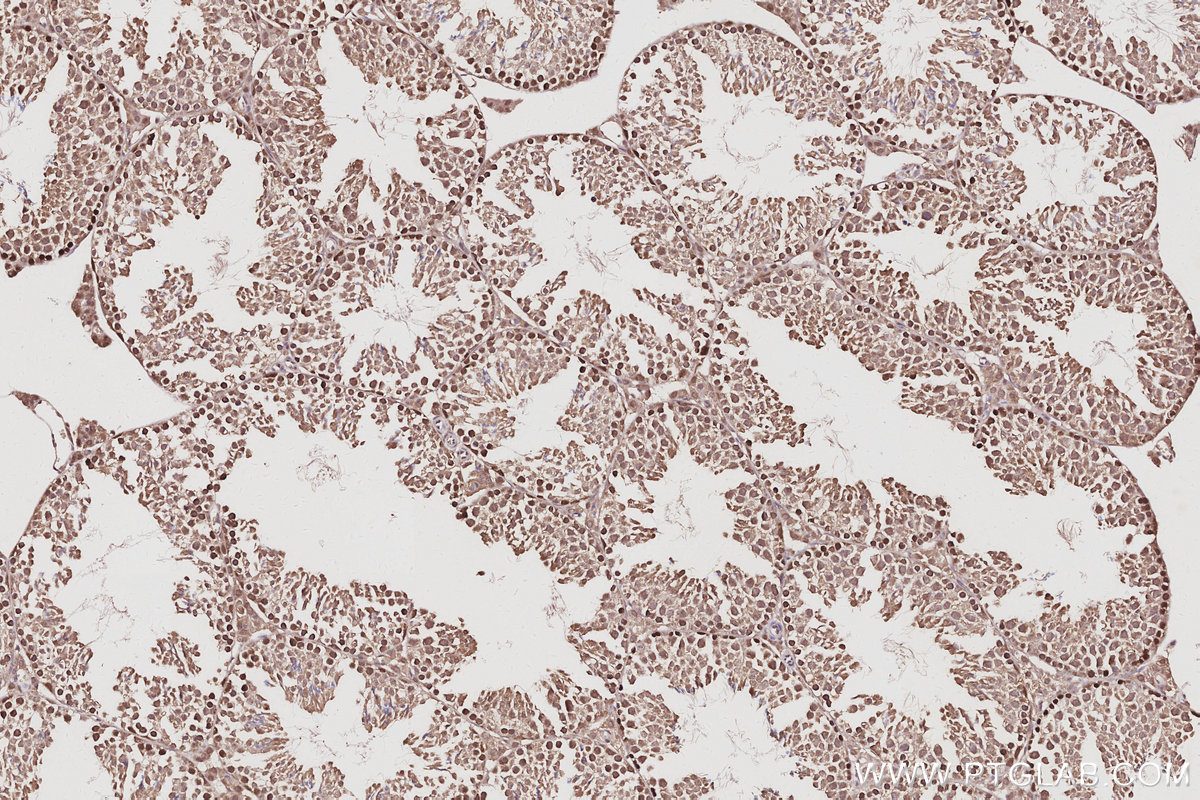 Immunohistochemical analysis of paraffin-embedded mouse testis tissue slide using KHC3082 (RNF114 IHC Kit). Immunohistochemical analysis of paraffin-embedded mouse testis tissue slide using KHC3082 (RNF114 IHC Kit).