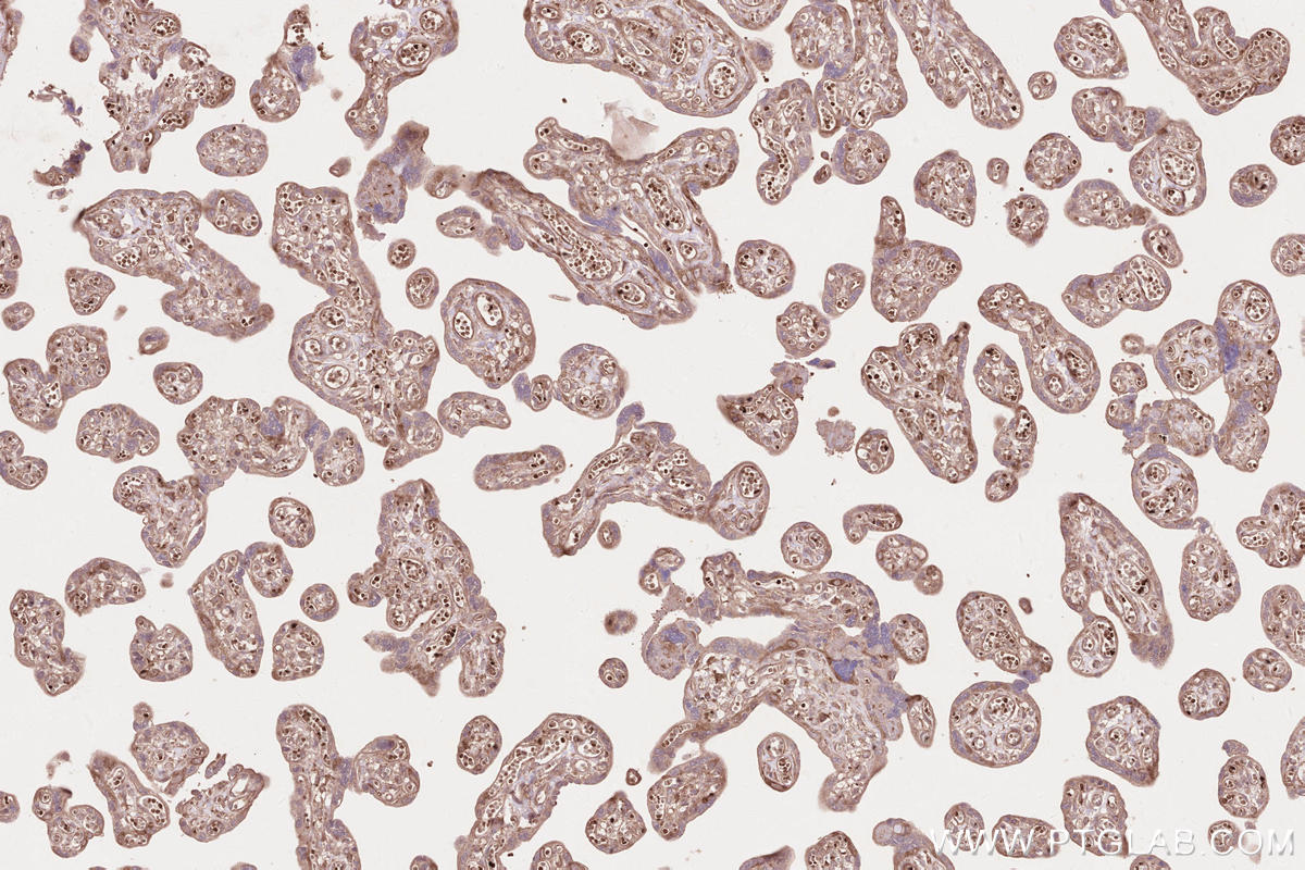 Immunohistochemical analysis of paraffin-embedded human placenta tissue slide using KHC2566 (RNF123 IHC Kit).