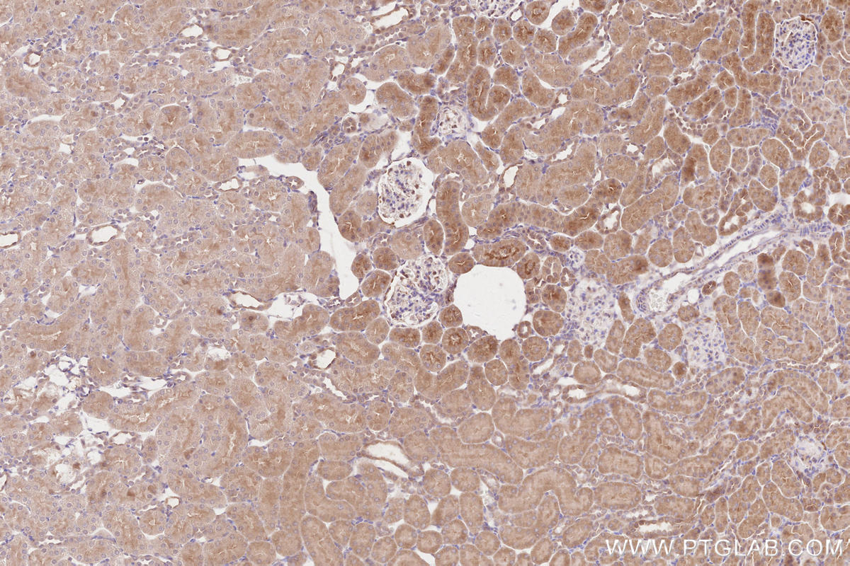 Immunohistochemical analysis of paraffin-embedded rat kidney tissue slide using KHC2566 (RNF123 IHC Kit).